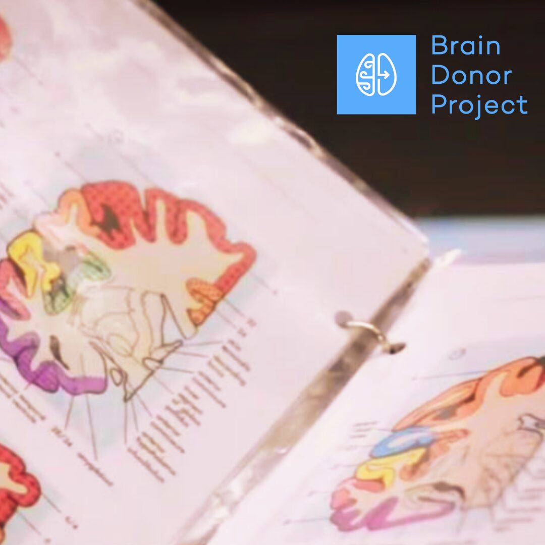 brain donor project